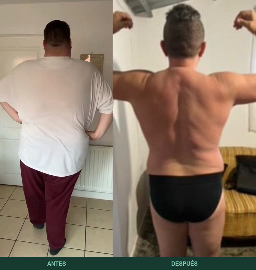 Ángel, enfermero encargado de la UVI: antes y después, de espalda