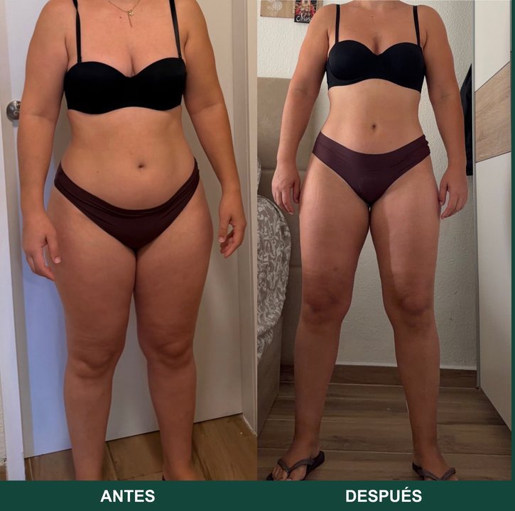 Melania, antes y después, de frente